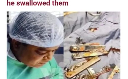 Doctors in India were shocked to find keys, nail clippers, and even a knife from the stomach of a man, reported to be in his early twenties.