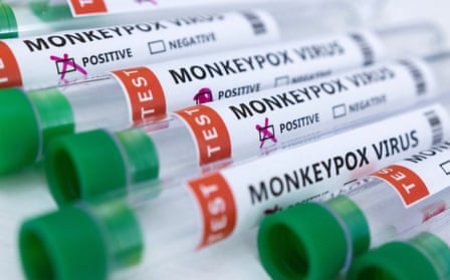 Two new cases of monkeypox confirmed in Cross River state