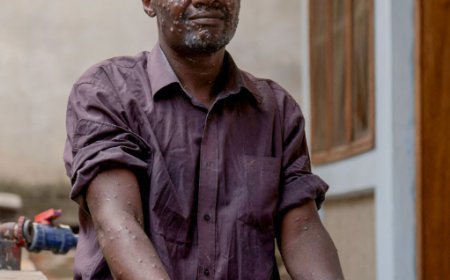 NCDC reports higher Mpox infection among males in Nigeria