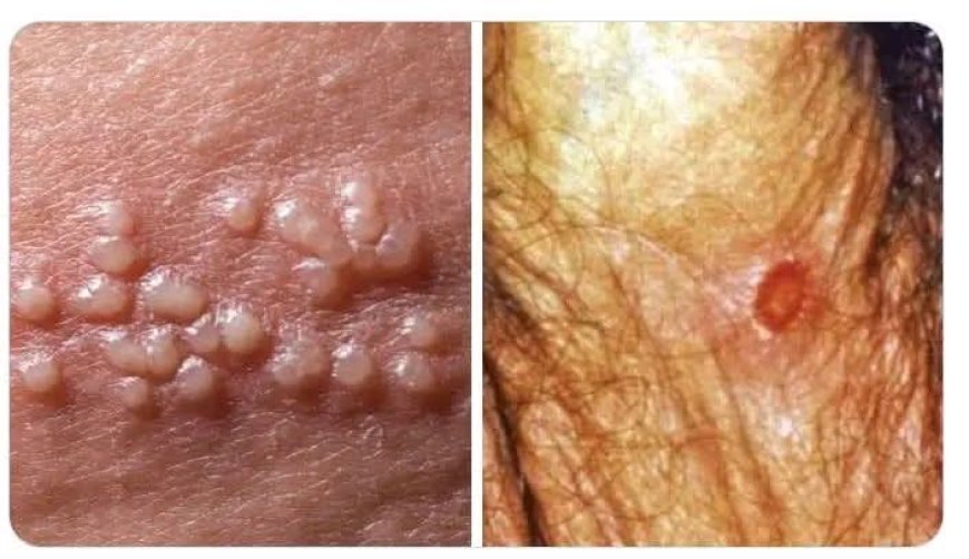 10 Things You Must Check Before S£xual Intimacy