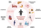 OBESITY AND HEART ATTACKS