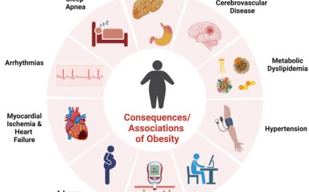 OBESITY AND HEART ATTACKS
