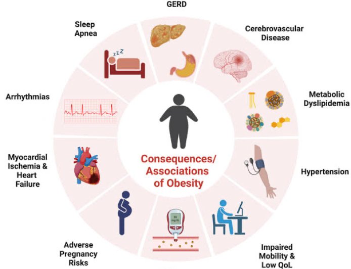 OBESITY AND HEART ATTACKS