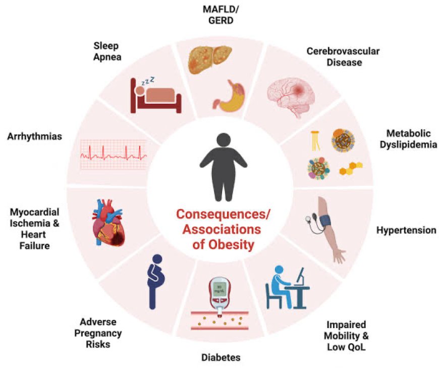 OBESITY AND HEART ATTACKS
